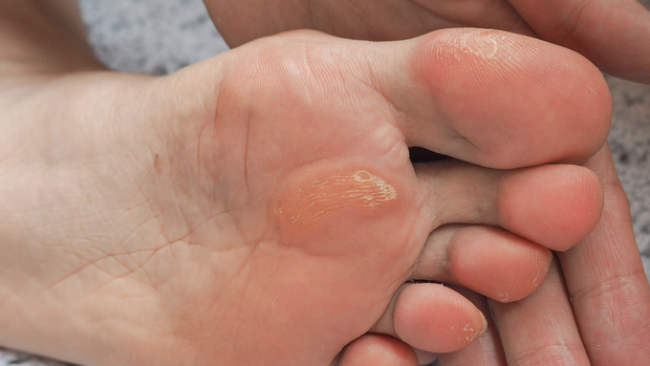 Foto - Ayak bakım suyuna 1 kaşık ekleyin! Yorgunluğu, nasırı ve kötü kokuyu sıfırlıyor