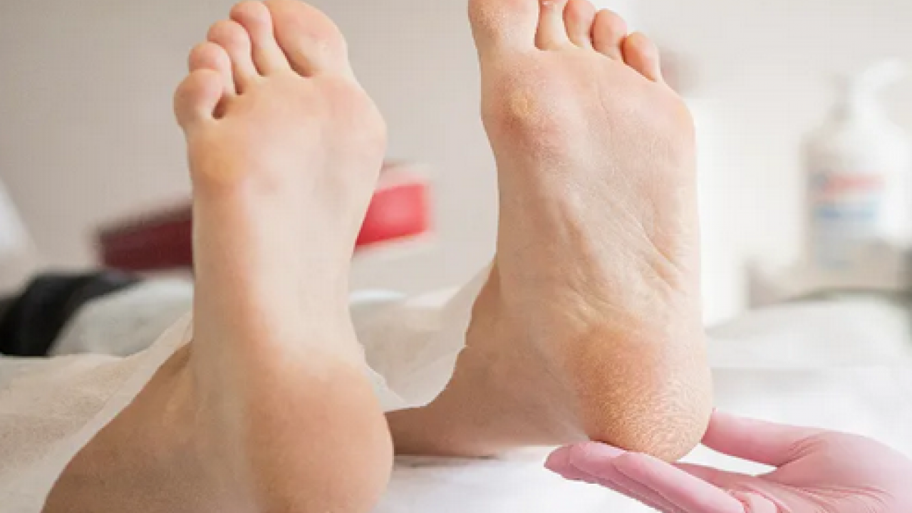 Foto - Ayak bakım suyuna 1 kaşık ekleyin! Yorgunluğu, nasırı ve kötü kokuyu sıfırlıyor