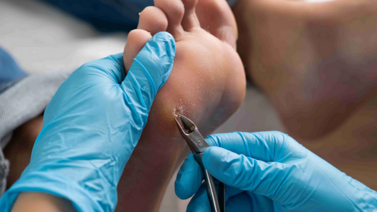 Foto - Ayak bakım suyuna 1 kaşık ekleyin! Yorgunluğu, nasırı ve kötü kokuyu sıfırlıyor