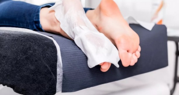 Ayak nasırını yok eden çözüm! İşte en basit yolu