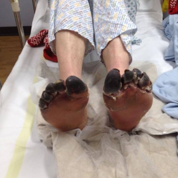 Ayak parmaklarını gören şok oluyor