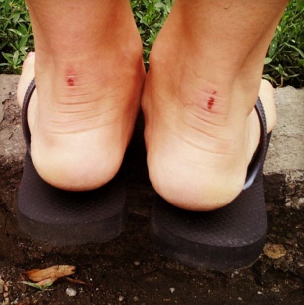 Foto - Ayakkabı vurmasını böyle engelleyin