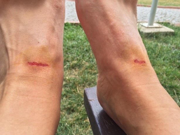 Foto - Ayakkabı vurmasını böyle engelleyin