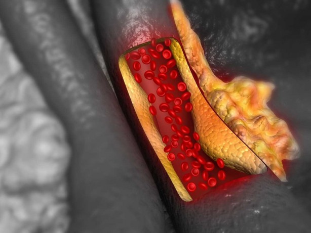 Foto - Öğrenince şok olacaksınız! Salatalık ile hayatınızı kolaylaştırın