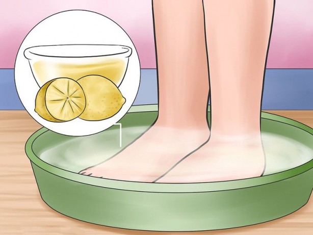 Foto - Ayaklardaki nasırları yok edecek en etkili yöntem: Yeniden güçlendirilmeli! Nasırı kökünden söken destek 