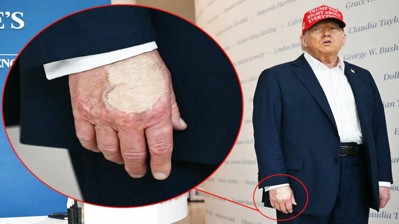 Foto - Ayakları şişip elleri morarmıştı! Trump, "Öldü" iddiaları için bakın ne dedi
