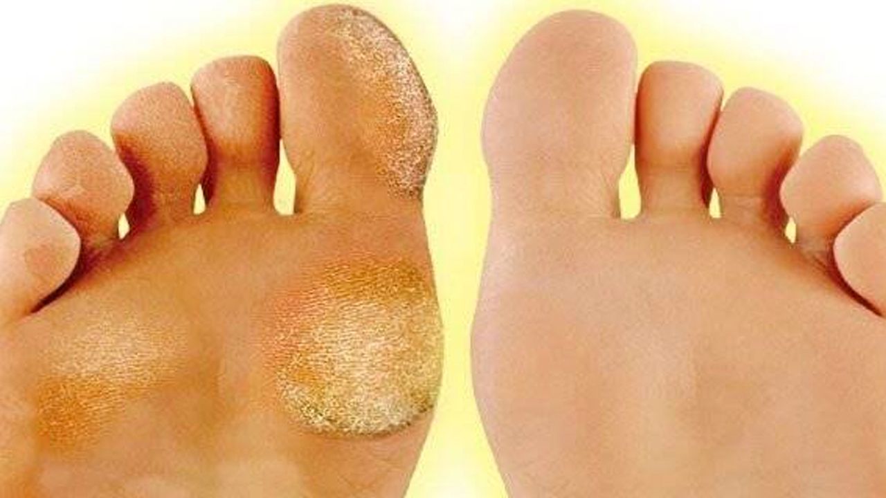 Foto - Ayaklarınıza ondan sürün, ne mantar kalsın ne de nasır: Su serpin! Bu yağ doğal şifa kaynağı