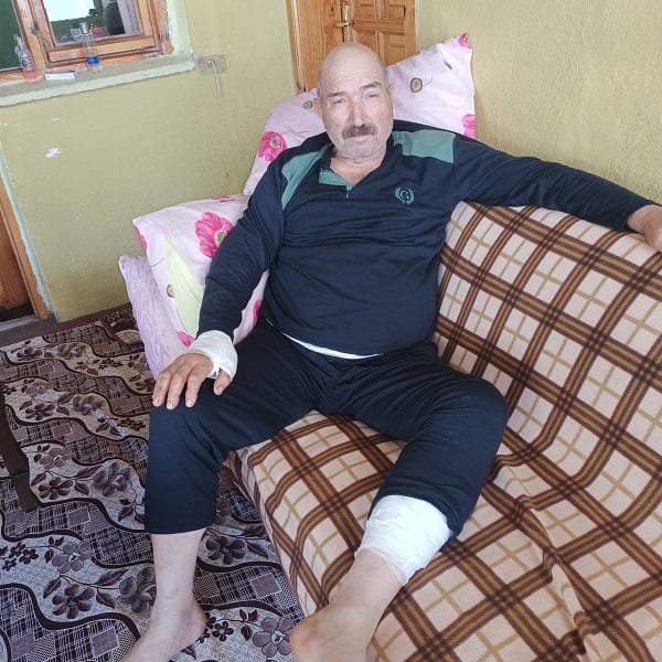 Foto - Ayı saldırısına uğradı, o dehşet anlarını anlattı