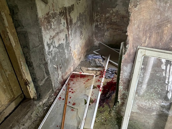 Foto - Ayı saldırısına uğradı, o dehşet anlarını anlattı