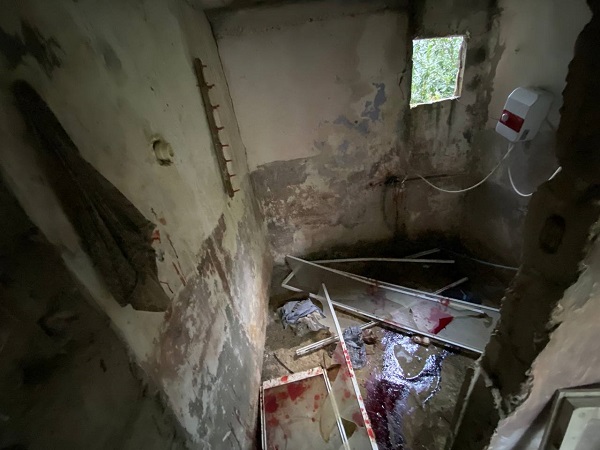 Ayı saldırısına uğradı, o dehşet anlarını anlattı