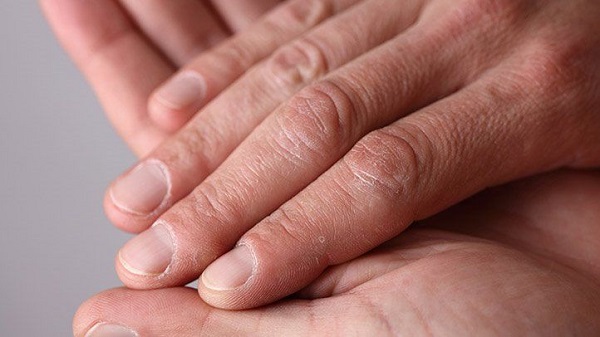 Foto - Aynı durumu yaşıyor musunuz? Tırnaklarınız bu yüzden hızlı uzuyor