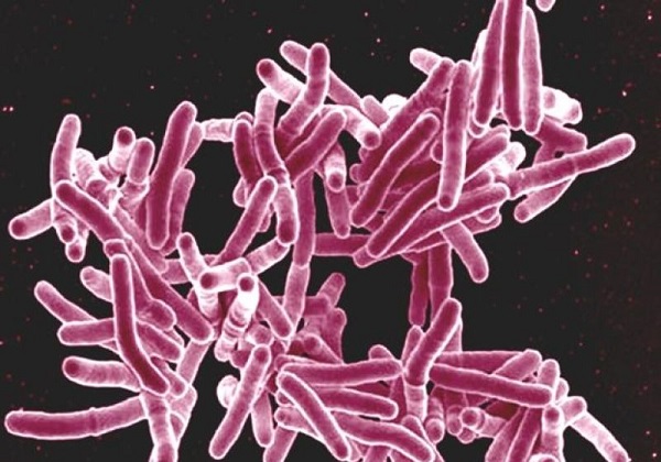 Foto - Aynı sorunu mu yaşıyorsunuz? Bitmek bilmeyen öksürüğün sebebi bu olabilir