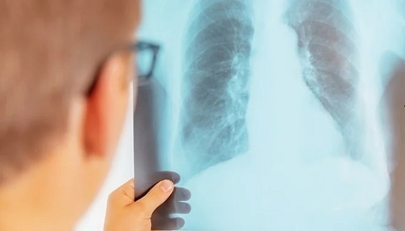 Aynı sorunu mu yaşıyorsunuz? Bitmek bilmeyen öksürüğün sebebi bu olabilir