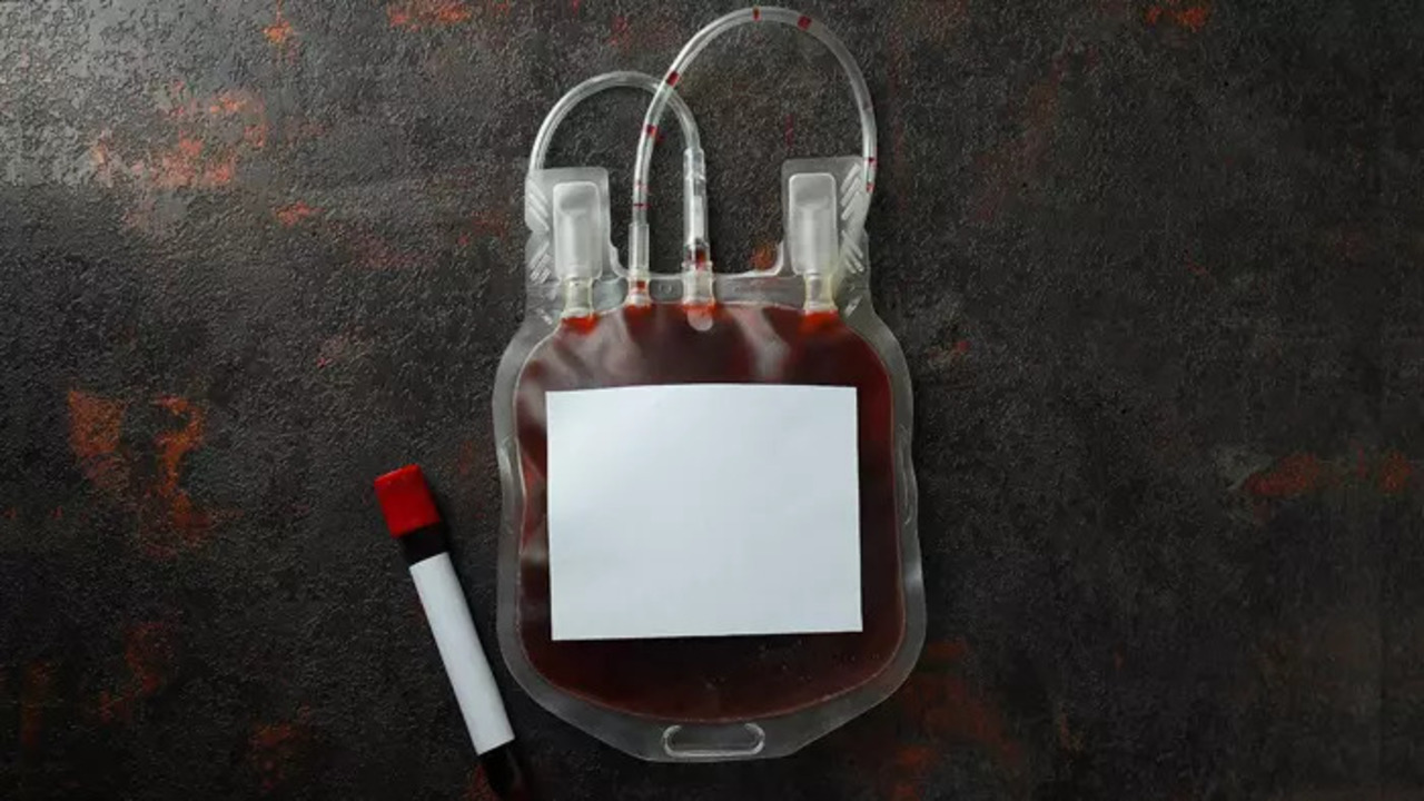 Foto - B Kan Grubu Sahiplerine Japonlardan müjde!