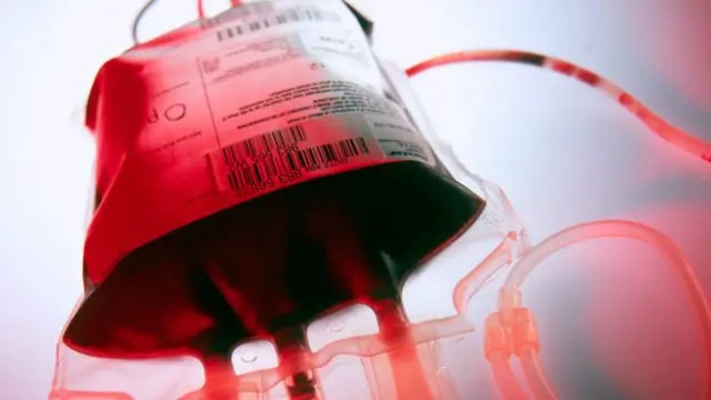 Foto - B Kan Grubu Sahiplerine Japonlardan müjde!