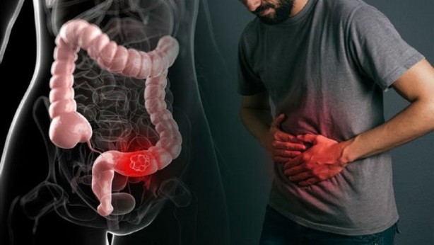 Foto - B12 vitamini deyip geçmeyin! Bu 3 besini mutlaka tüketin...