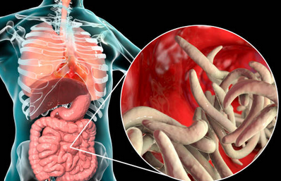 Foto - Bağırsak Kurduna doğal çözümler! Bağırsak temizleme nasıl yapılır? Merak ediyorsanız İşte o yöntem, artık olmayacak