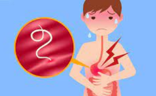 Bağırsak Kurduna doğal çözümler! Bağırsak temizleme nasıl yapılır? Merak ediyorsanız İşte o yöntem, artık olmayacak