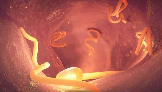 Foto - Bağırsak Kurduna doğal çözümler! Bağırsak temizleme nasıl yapılır? Merak ediyorsanız İşte o yöntem, artık olmayacak