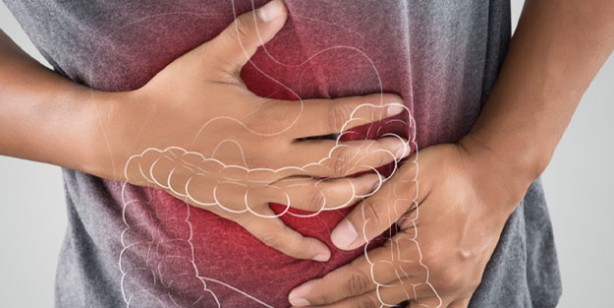 Foto - Bağırsak tıkanıklığını gösteren işaretler