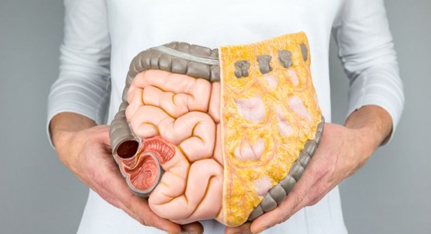 Foto - Bağırsak tıkanıklığını gösteren işaretler