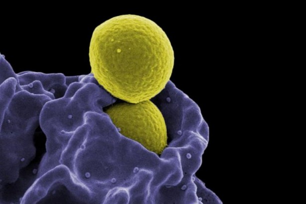 Foto - Bağışıklık sisteminini güçlü tutmak için neler yapmalıyız?