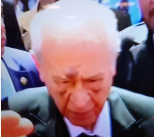 Foto - Bahçeli'nin yüzündeki morlukların sebebi belli oldu! Kahreden haber