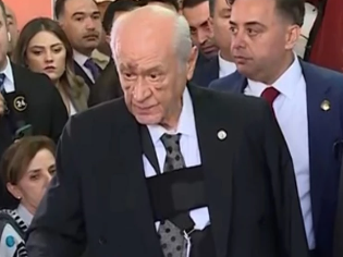 Foto - Bahçeli'nin yüzündeki morlukların sebebi belli oldu! Kahreden haber