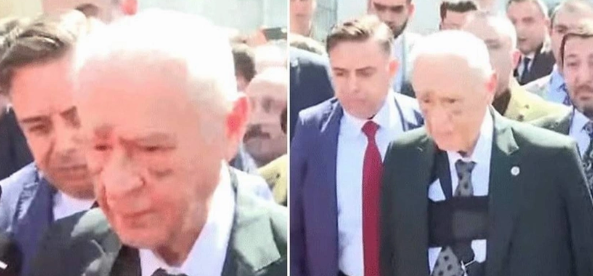 Foto - Bahçeli'nin yüzündeki morlukların sebebi belli oldu! Kahreden haber