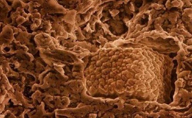 Foto - Bakalım yiyecekleri mikroskobik görüntülerinden tanıyabilecek misiniz?