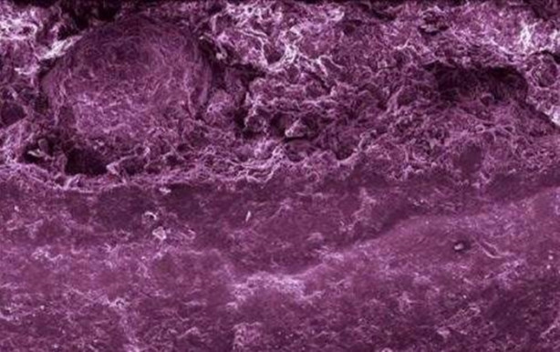 Foto - Bakalım yiyecekleri mikroskobik görüntülerinden tanıyabilecek misiniz?