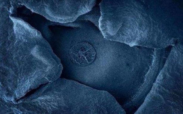 Foto - Bakalım yiyecekleri mikroskobik görüntülerinden tanıyabilecek misiniz?