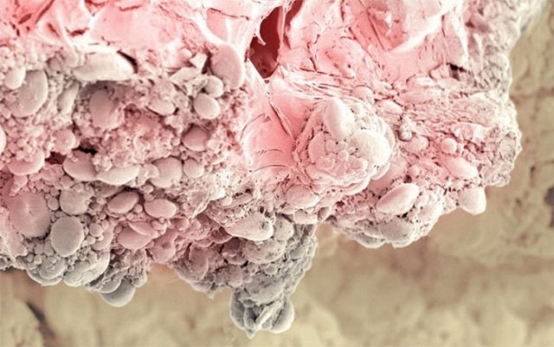 Foto - Bakalım yiyecekleri mikroskobik görüntülerinden tanıyabilecek misiniz?