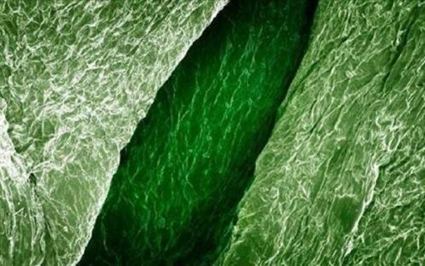 Foto - Bakalım yiyecekleri mikroskobik görüntülerinden tanıyabilecek misiniz?