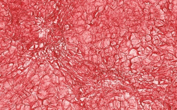 Bakalım yiyecekleri mikroskobik görüntülerinden tanıyabilecek misiniz?