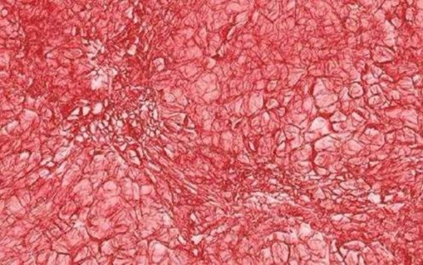 Foto - Bakalım yiyecekleri mikroskobik görüntülerinden tanıyabilecek misiniz?