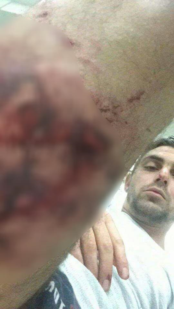 Foto - Bakan Çavuşoğlu Hollanda'daki şok görüntüleri paylaştı!