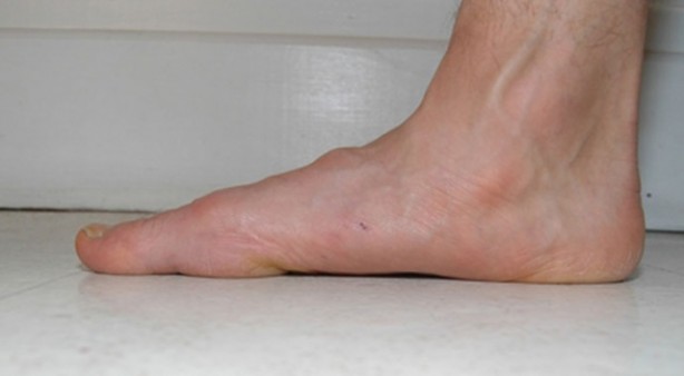 Foto - Baş ağrısının 6 nedeni şaşırtıyor