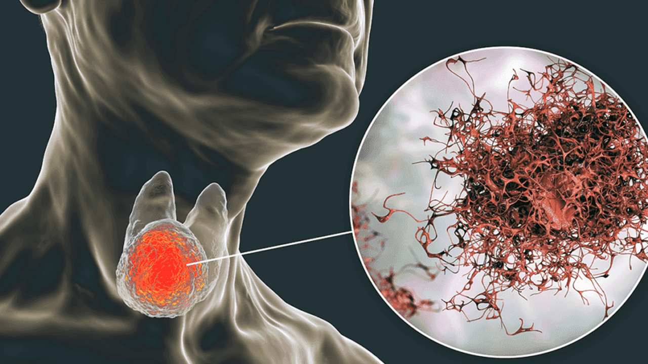  Baş-Boyun kanserlerinde de risk faktörü: HPV aşısı başvuruları devam ediyor 