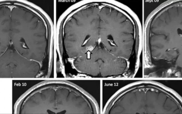 Foto - Başı ağrıyan hastanın alnından çıkan canlı yok artık dedirtti!