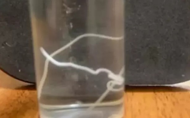 Foto - Başı ağrıyan hastanın alnından çıkan canlı yok artık dedirtti!