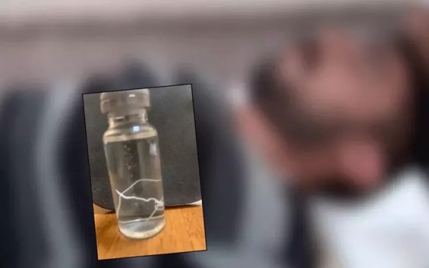 Başı ağrıyan hastanın alnından çıkan canlı yok artık dedirtti!