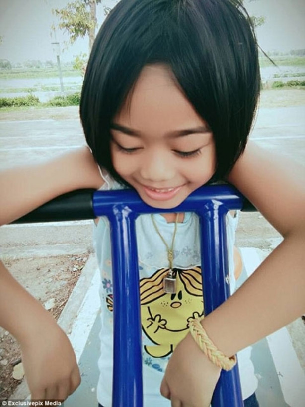 Foto - Başı ağrıyınca gözlerinden kan geliyor!