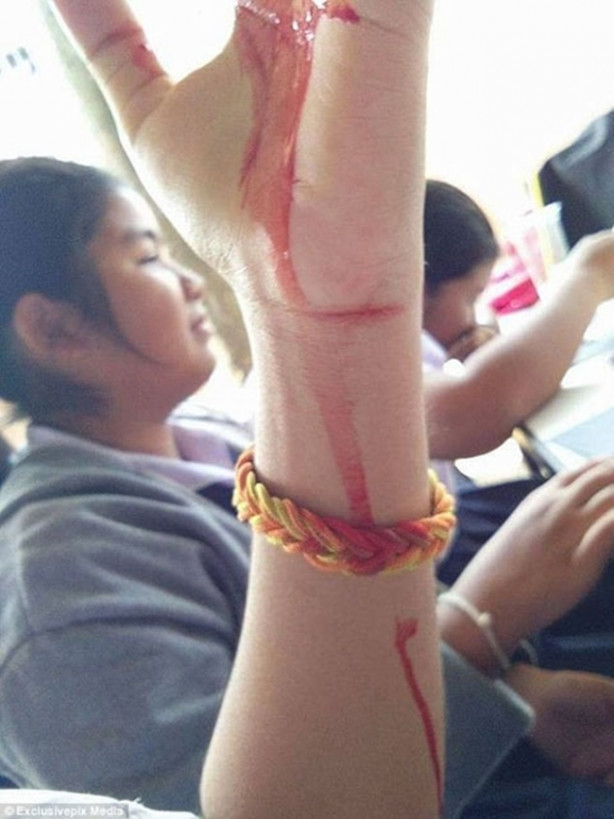 Foto - Başı ağrıyınca gözlerinden kan geliyor!