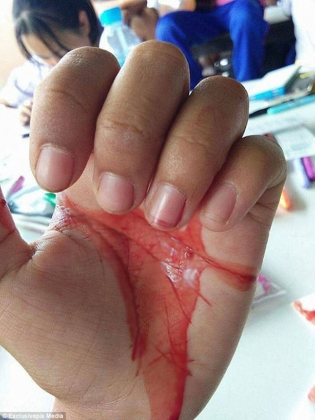 Foto - Başı ağrıyınca gözlerinden kan geliyor!