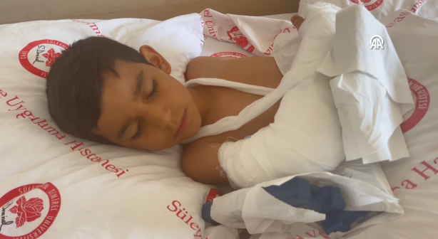 Foto - Başıboş köpekler 7 yaşındaki çocuğa saldırdı