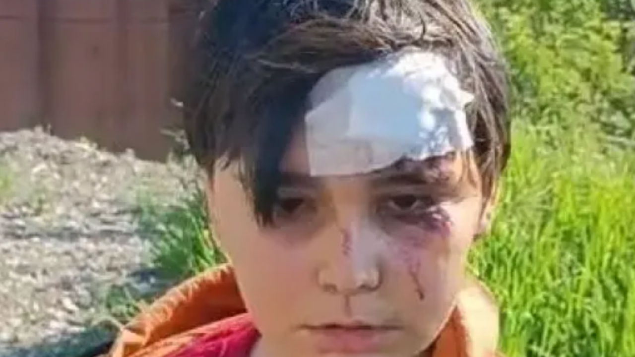 Başıboş köpekler can yakmaya devam ediyor! 2 çocuk saldırıya uğradı!