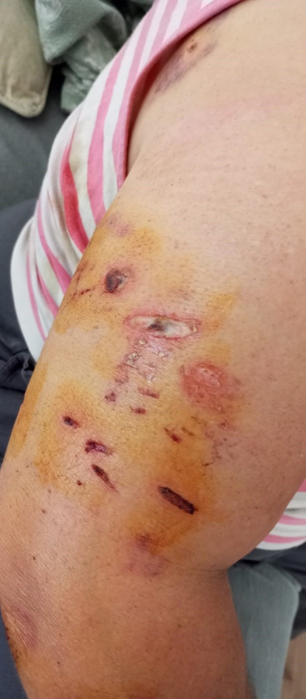 Foto - Başıboş köpekler saldırmıştı! Tek başına sokağa çıkamıyor