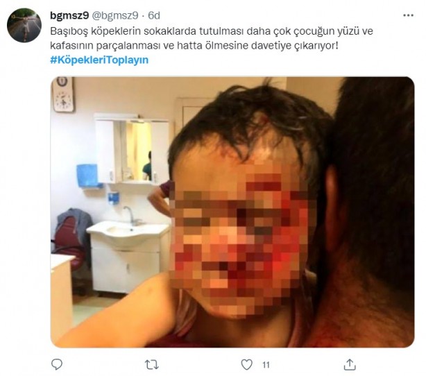 Foto - Başıboş köpeklerin 7 yaşındaki çocuğu ağır yaralamasının ardından vatandaşlar ayağa kalktı!