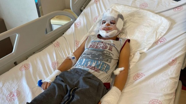 Foto - Başıboş köpeklerin 7 yaşındaki çocuğu ağır yaralamasının ardından vatandaşlar ayağa kalktı!